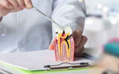 Root Canal Process and Its Impact on Tooth Longevity